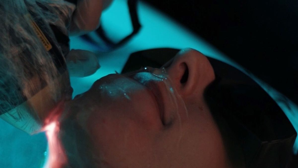Lazer epilasyon kaç seans sürer ve neye göre değişir — RL Beauty Lounge