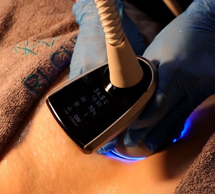EmTone: Firmer Skin, Reduced Cellulite Appearance — RL Beauty Lounge Ankara