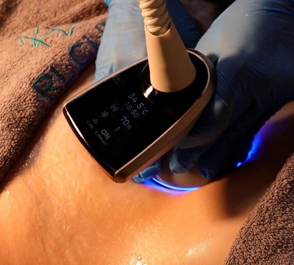 BTL EXION uygulama başlığı cilt üzerinde — RL Beauty Lounge Ankara